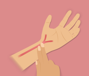 Tipos de pulso arterial: como identificar, avaliar e o que cada um indica clinicamente - WK Cursos e Saude